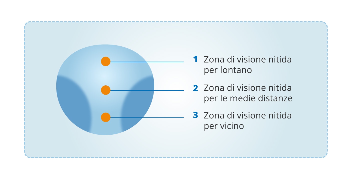 Occhiali progressivi o lenti a contatto per la presbiopia?